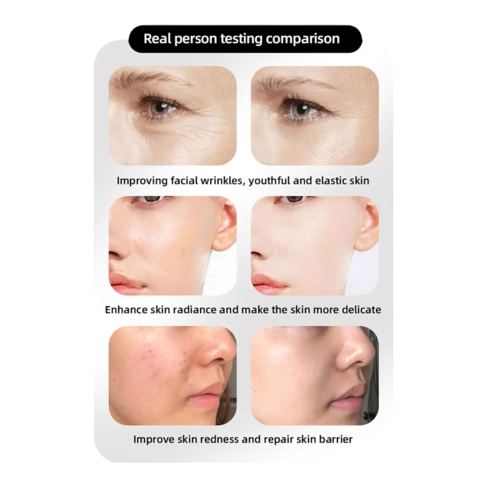 Mayor's Age Miracle LED Face Mask - Image 10